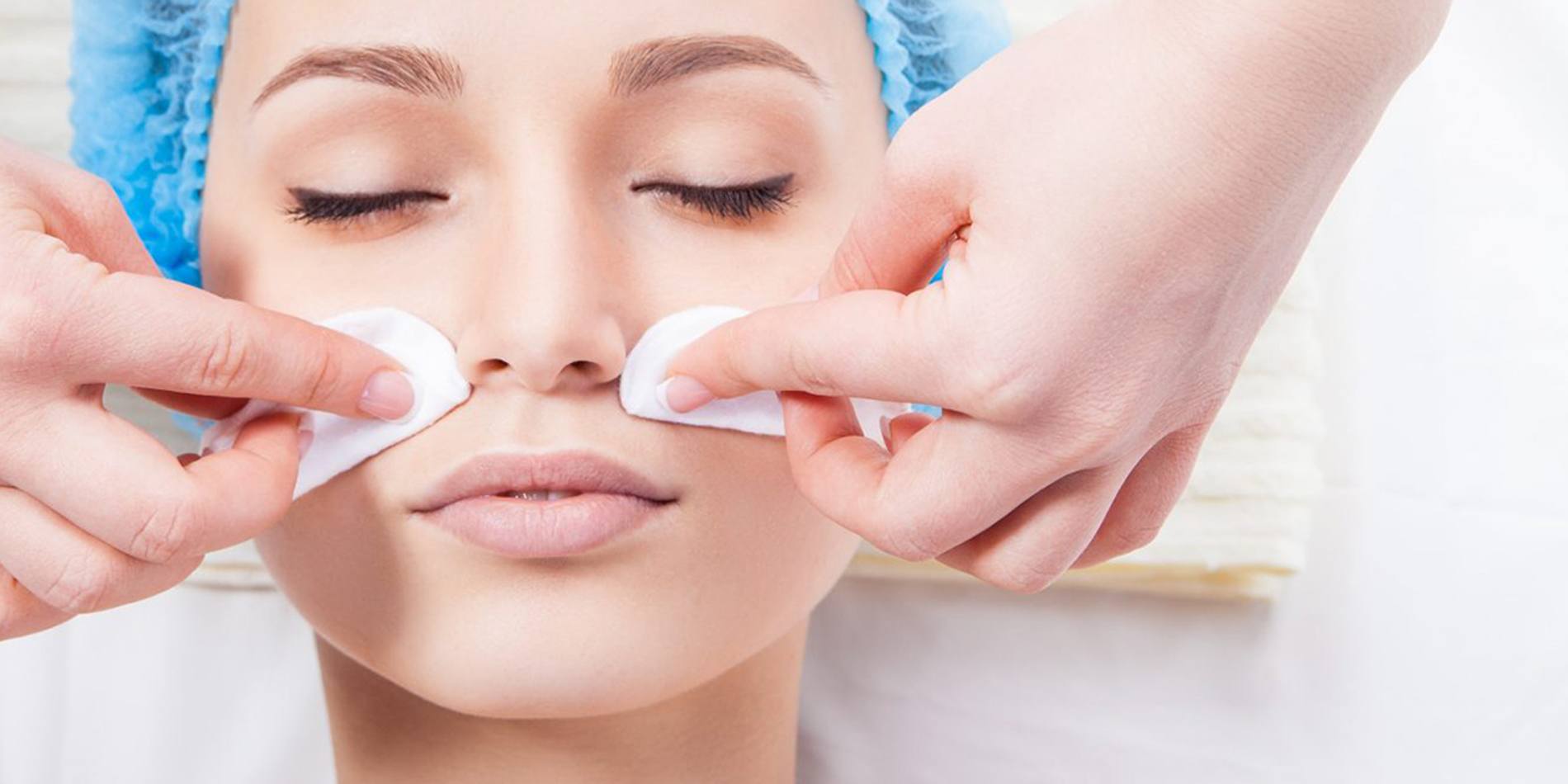 chemical-peel