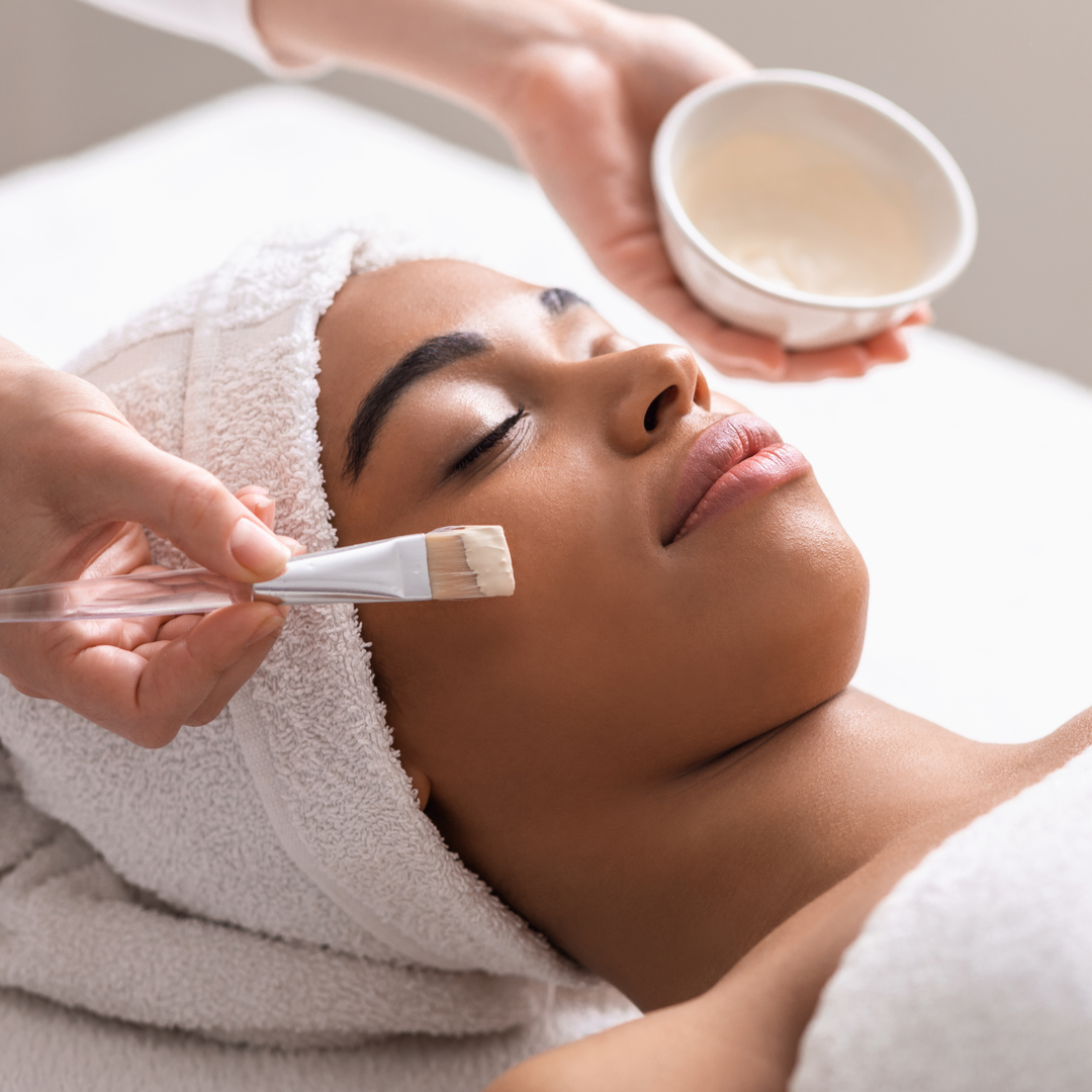 chemical-peel