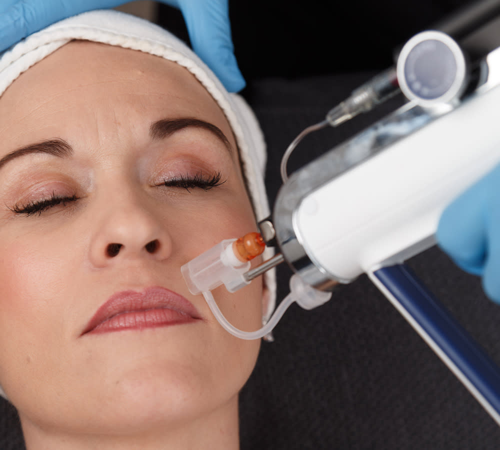 mesotherapy